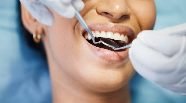 Best Emergency Wisdom Teeth Removal in Eureka, KS